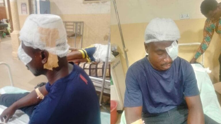 A horrific incident that took place at Asuoso Senior High School in Offinso in the Ashanti region has left a male teacher blind in one eye after a student stabbed him.