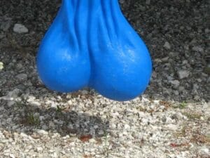 A Medical Doctor has refuted the assertion that men experience 'blue balls' when they do not engage in sexual activity after becoming aroused.