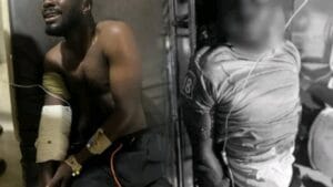 Two Immigration officers have allegedly been shot and severely injured in an ambush at Nagani in the Tempane District of the Upper East Region.