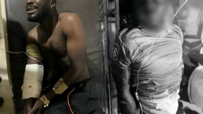 Two Immigration officers have allegedly been shot and severely injured in an ambush at Nagani in the Tempane District of the Upper East Region.