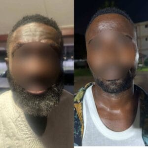 The Ghana Police Service, through the Office of the Special Operations Assistant to the IGP, has arrested seven suspects in connection with a robbery syndicate linked to a series of attacks across Accra