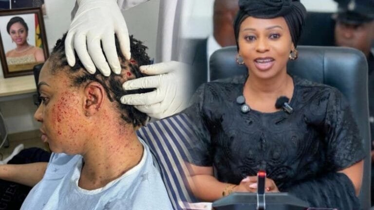 The spokesperson for the Safo Kantanka family, Dr. Emmanuel Boakye, has stated that former Dome-Kwabenya MP, Sarah Adwoa Safo, is in critical condition and may not survive the injuries sustained in an alleged shooting incident.